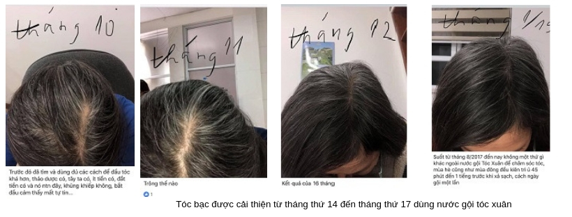 Nước gội đầu trị bạc tóc